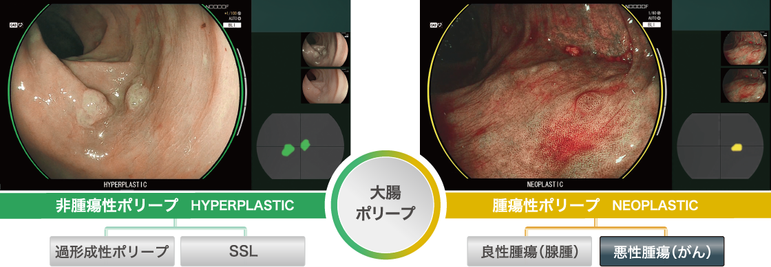 疾患鑑別支援