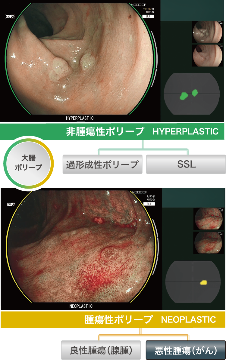 疾患鑑別支援