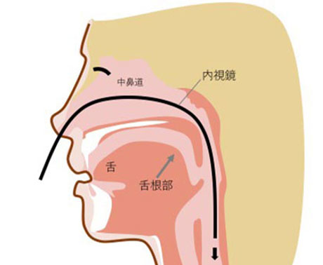 鼻からの場合